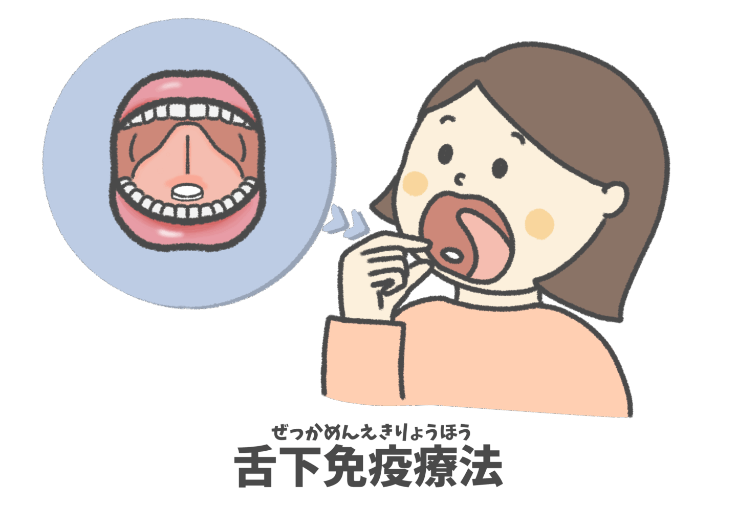 舌下免疫療法