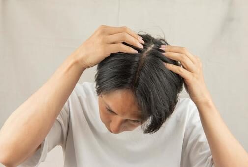 AGA（男性型脱毛症）のオンライン診療