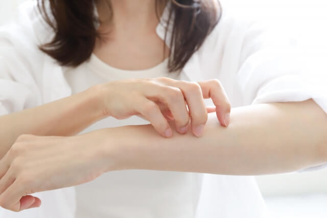 貨幣状湿疹の原因・症状・治し方は？強いかゆみ対策と「たむし」との見分け方を画像で医師が解説！