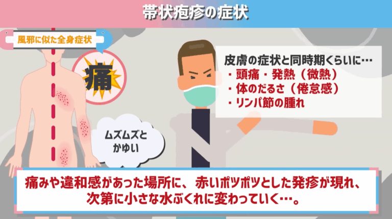 帯状疱疹とは?症状や原因を徹底解説!こんな初期症状に注意!【医師監修】 - オンライン診療ならウチカラクリニック