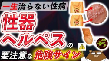 性器ヘルペスとは?症状・原因・治療法・予防法について医師が完全解説!