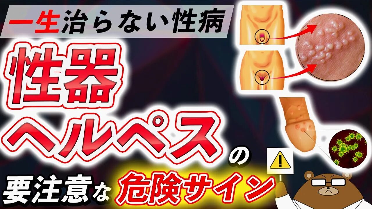 性器ヘルペスとは？症状・原因・治療法・予防法について医師が完全解説！