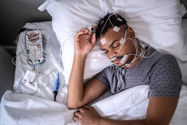 精密検査(PSG)のイメージ図