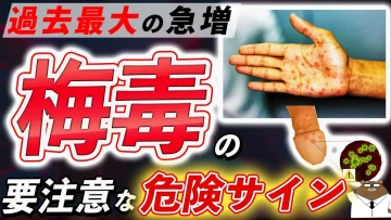 梅毒とは?症状・原因・薬の治療法・予防法について医師が完全解説!
