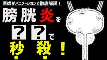 膀胱炎の治し方・一晩で治す方法について医師が解説