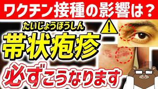 帯状疱疹とは？症状や原因を徹底解説！こんな初期症状に注意！【医師監修】