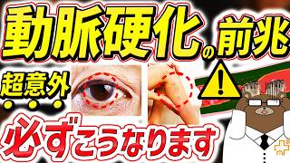 【危険】知らないと後悔する。全身で動脈硬化が進行すると起きる要注意な危険サイン。血管が詰まる寸前必ずこうなる。動脈硬化を防ぐ術はないのか。医師が完全解説。