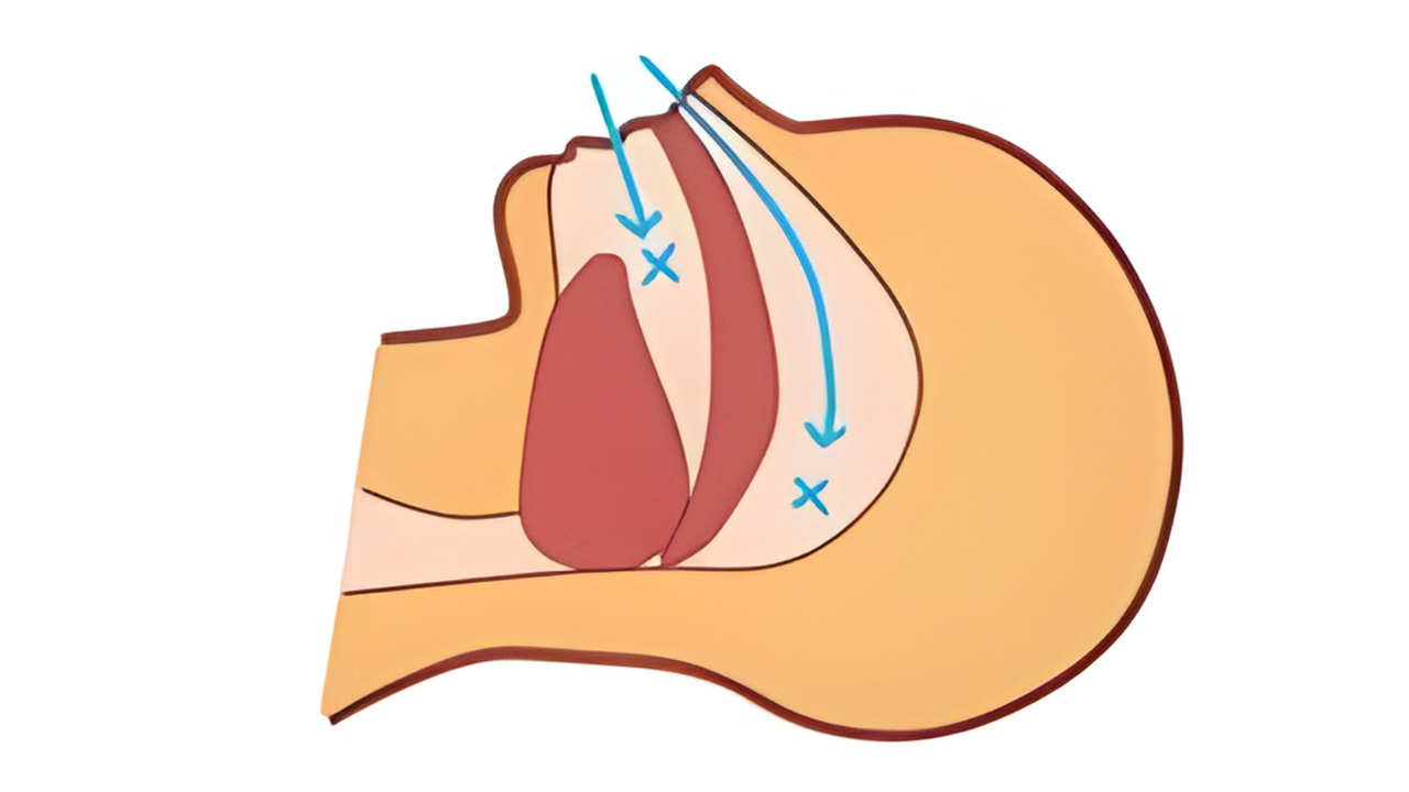 正常な気道のイラスト