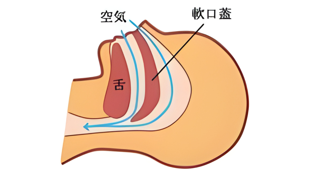 閉塞した気道のイラスト